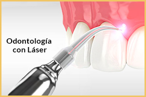 Laser Dentista Turquia